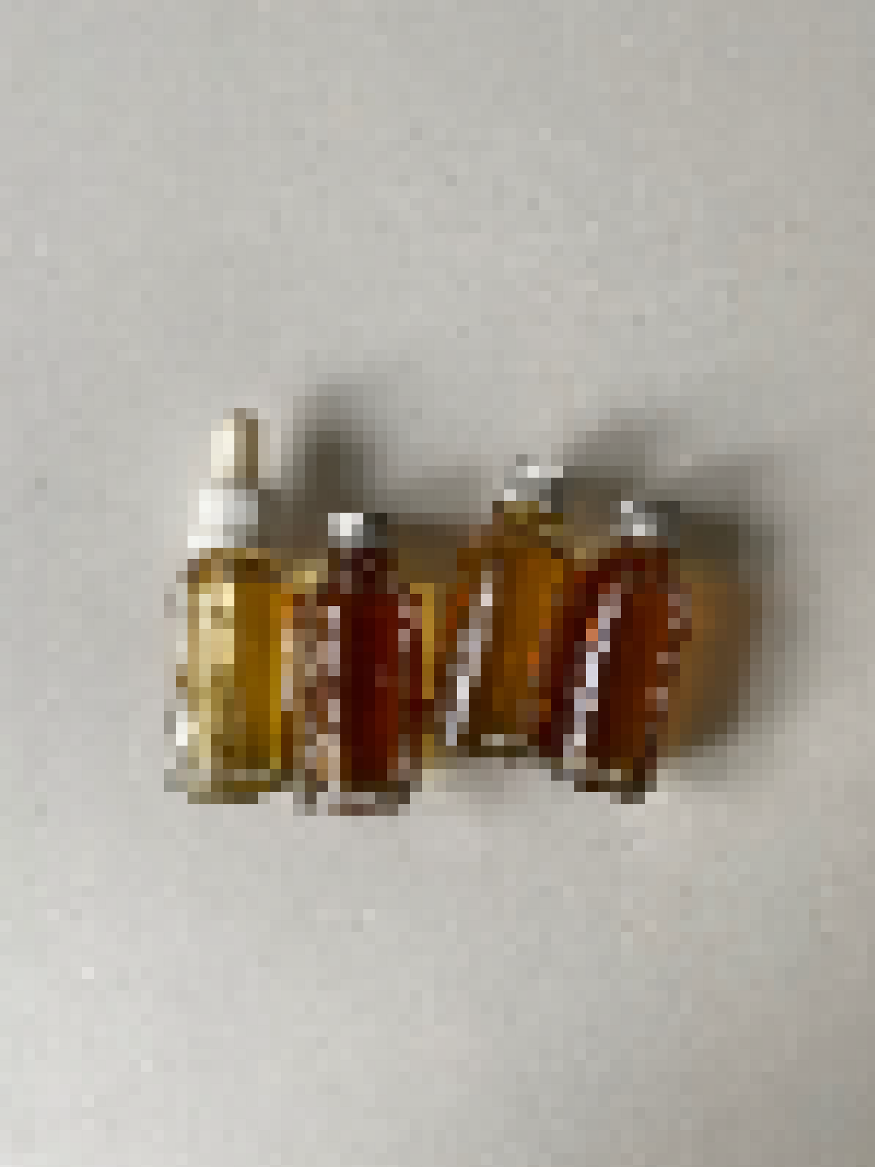 Stressed Made My Hair Fall Out, So I’m Launching a Hair Oil for Sensitive Scalps